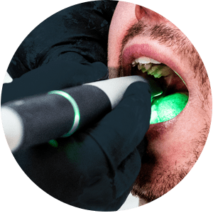 scanner-intraoral